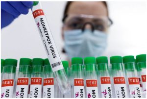 El recuento de casos de viruela del mono en España se eleva a 84, dice el Ministerio de Salud