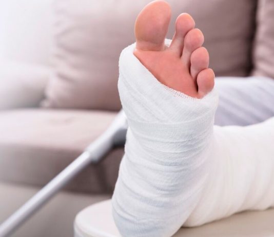 Bonus anual y absentismo prolongado: proporcionalidad, exclusión total y límites jurídicos en el cálculo de incentivos