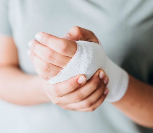 Delito de lesiones: ¿todo golpe es delito?