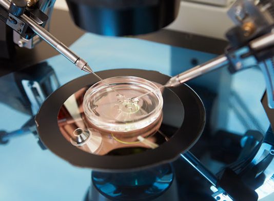 Reclaman un millón de euros al Servicio Andaluz de Salud por un error en una fecundación asistida