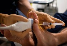 Síndrome de Morton, enfermedad invalidante