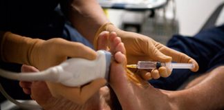 Síndrome de Morton, enfermedad invalidante