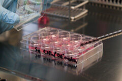 El juez encausa a una pareja por presunta estafa a 37 enfermos con ‘células madre’ Células