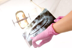 Negligencia dental: más allá del error humano Dentista