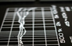 Los precios suben en diciembre un 0,8% interanual Gráfica en blanco y negro