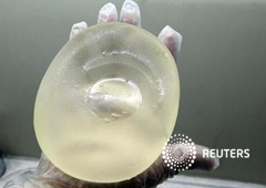 Una enfermera muestra un implante de silicona defectuoso de PIP tras ser retirado en una operción en Niza, el 5 de enero de 2012