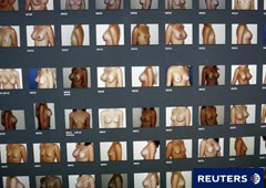 Los torsos de pacientes con implantes de mama en un ordenador en una clínica en Niza