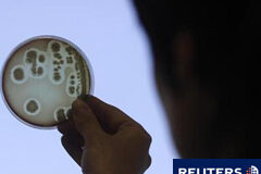 Unas semillas egipcias, origen más probable del E. coli mortal Una única remesa de semillas de alhovas procedente de Egipto es el origen más probable de una altamente tóxica epidemia de E. coli en Alemania que ha matado a 49 personas y de un brote más pequeño en Francia, dijeron el martes investigadores europeos. En