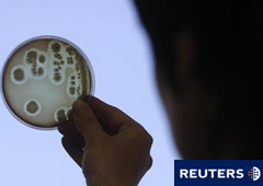 Una única remesa de semillas de alhovas procedente de Egipto es el origen más probable de una altamente tóxica epidemia de E. coli en Alemania que ha matado a 49 personas y de un brote más pequeño en Francia, dijeron el martes investigadores europeos. En