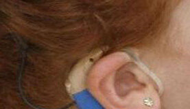 El TSXG condena al Sergas a pagar 200.000 euros por diagnosticar de sordera y operar a un niño que era autista Audífono