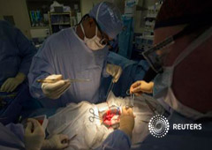 Una operación para trasplantar un riñón en en Nueva York, el 1 de agosto de 2012