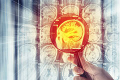 Absuelta a pesar de retener a su marido y obligarle a tratar su tumor cerebral con medicina naturista Cerebro ampliado con una lupa