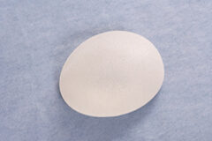 El TJUE precisa el alcance de las obligaciones de los organismos nacionales encargados del control de los fabricantes de implantes mamarios Implantes mamarios