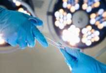 EL IVA ingresa en el quirófano Unas manos enguantadas pasándose unas tijeras quirúrgicas