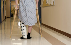 La Incapacidad Laboral Transitoria como forma de ABSENTISMO LABORAL “justificado” Una persona en un hospital con la pierna escayolada y con muletas.