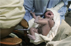 Un bebé recien parido llorando en brazos de los médicos.