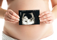 Una embarazada con una ecografía