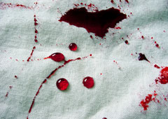 Una tela manchada de sangre.