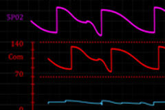 Cuestión de vida o muerte Monitor electro