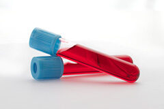 Utilización en el proceso penal de muestras de sangre obtenidas con fines terapéuticos Dos tubos con sangre